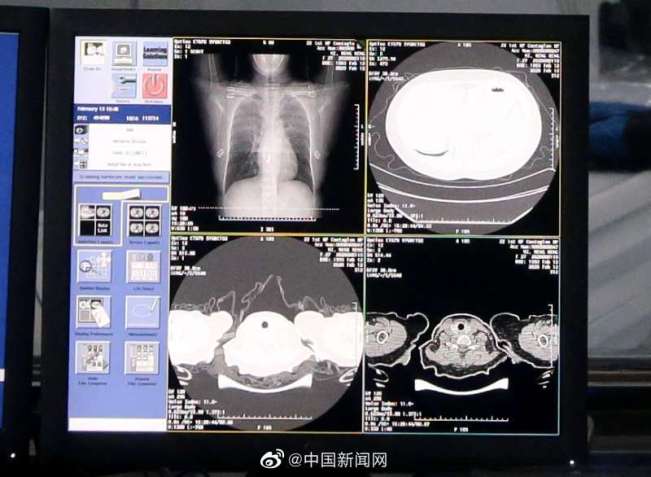 疫情当前，才知道AI原来是这么好用
